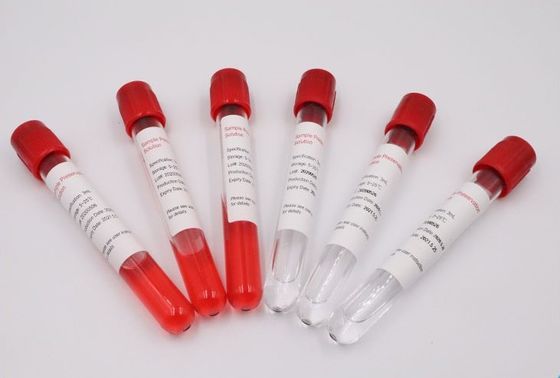 Resistencia ultra de alto impacto médica de los tubos del espécimen de la sangre del ABS