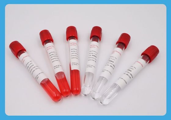 óxido de etileno especial del tubo de la colección de la muestra del hilo 5ml
