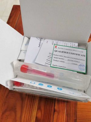 Tubos del espécimen de la sangre de la prueba de la gripe del virus
